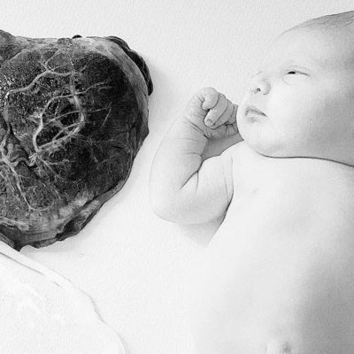Cheshire Placenta
